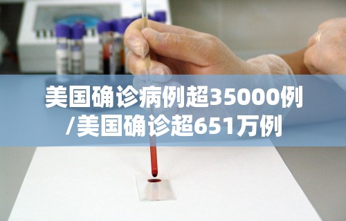 美国确诊病例超35000例/美国确诊超651万例
